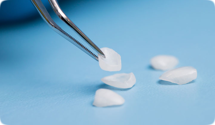 วีเนียร์