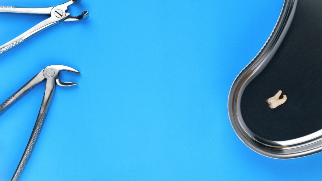 ผ่าฟันคุด